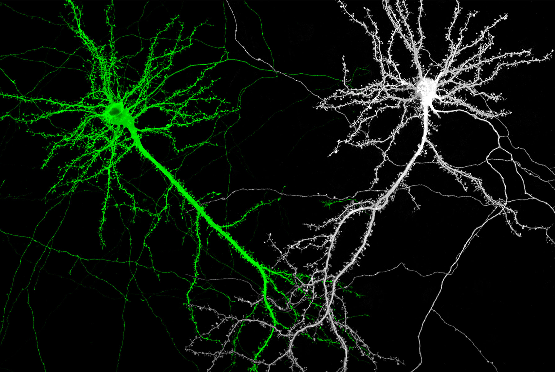 細數神經細胞的突觸點點