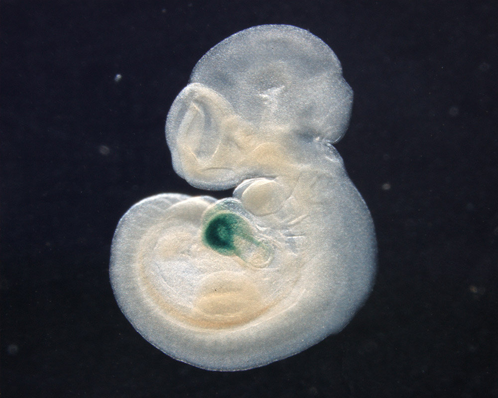 一個十天半大之HspB7LacZ/+基因改造小鼠胚胎經由X-gal 染色處理後，呈現出小熱休克蛋白B7組織特異性之表現
